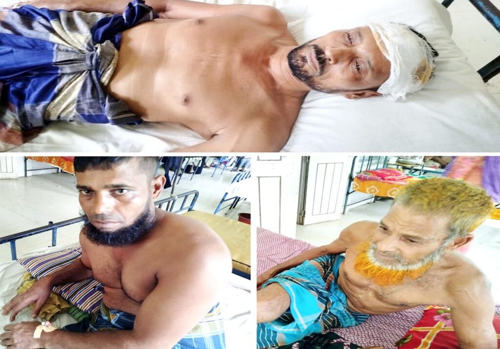 তেরখাদায় চার জনকে কুপিয়ে জখম 2 6 5