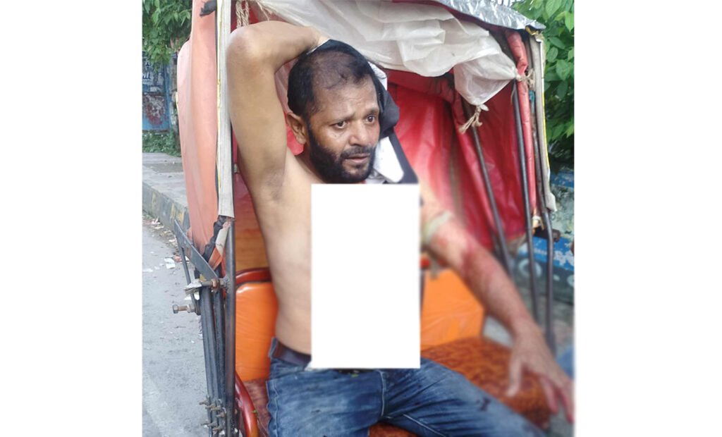 নগরীতে অজ্ঞাত দুর্বৃত্তদের ছুরিকাঘাতে আহত ১ 7 15 12