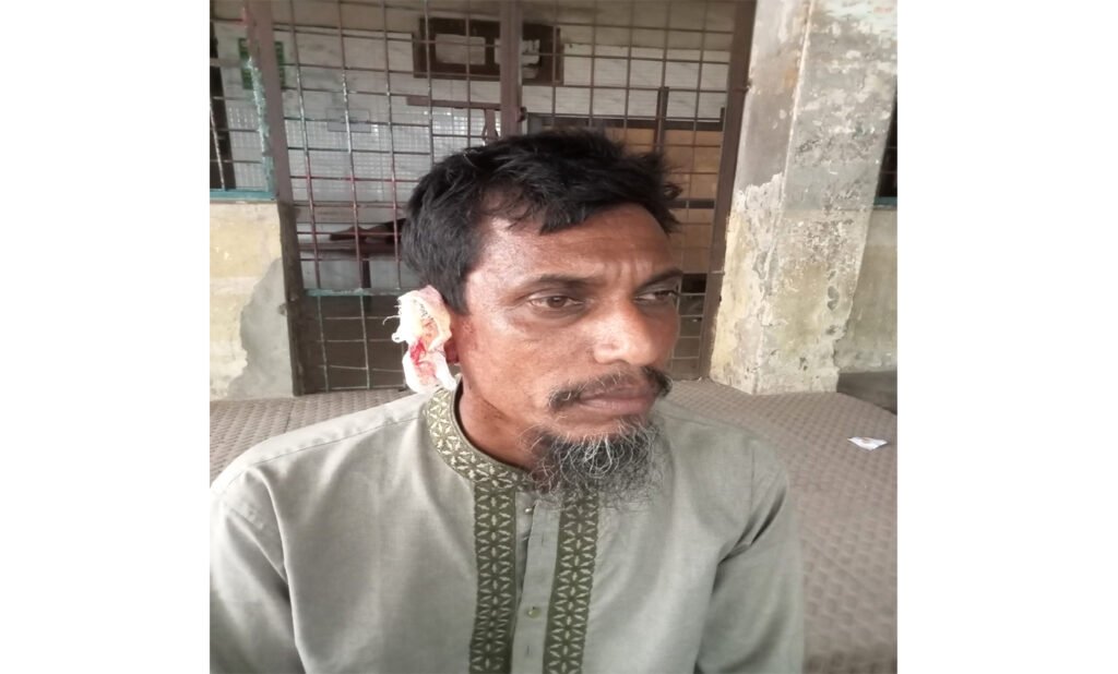 বাঁকিতে সিগারেট না দেওয়ায় কামড়ে ছিড়লো দোকানীর কান 6 1 11