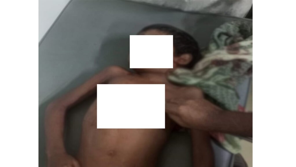 খুলনায় ইজিবাইকের ধাক্কায় প্রাণ গেলো শিশু রোহানের 2 6 9